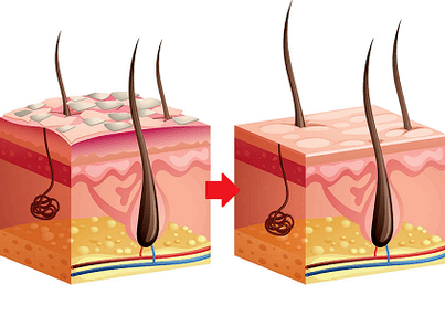 How Yenki Derm works